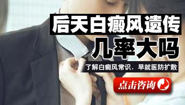 白癜风的遗传性